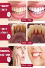 SP-4 Probiotics Re+Fresh Toothpaste - Image 3